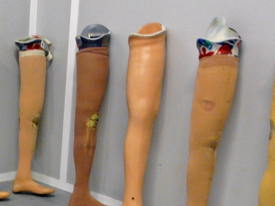 Appareillage orthop&eacute;dique 